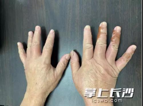 紧急提醒！石家庄街头、公园正大量出现！千万别随意“碰”！严重可致命……(图2)